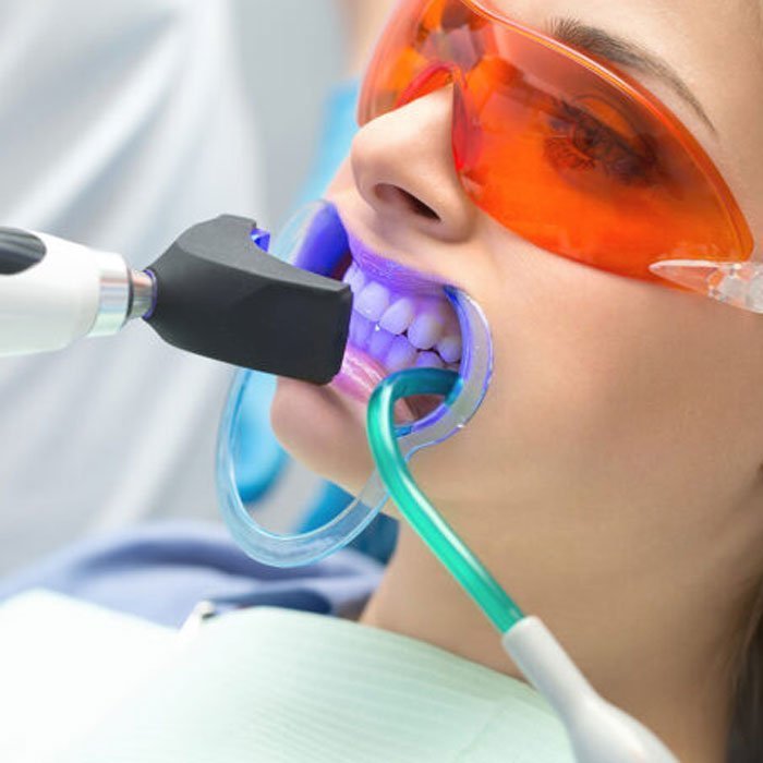 Teeth Whitening